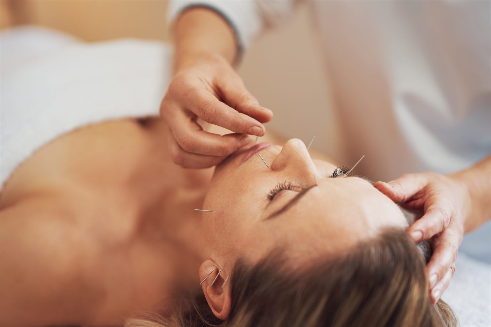 Acupuncture