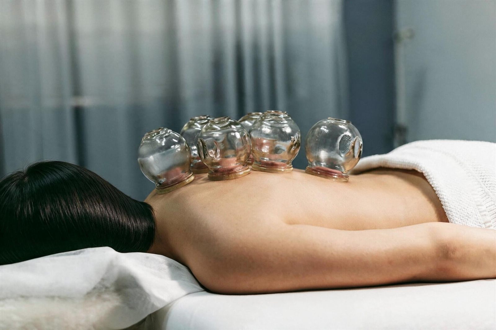 Hijama (Cupping)